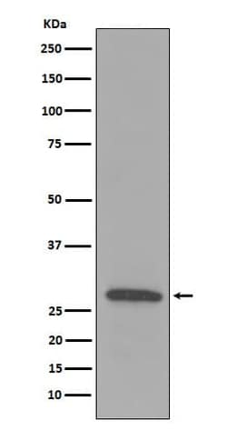 C1QB Antibody (SR1418), Novus Biologicals 50 &mu;g; Unconjugated:Antibodies,