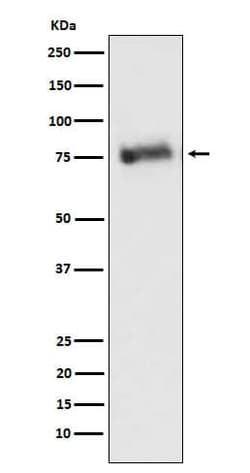 GRK3 Antibody (SR2232), Novus Biologicals:Antibodies:Primary Antibodies