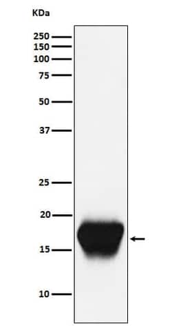 CD52 Antibody (SR2268), Novus Biologicals:Antibodies:Primary Antibodies