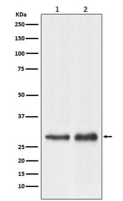 RPL7A Antibody (SR1517), Novus Biologicals 100 &mu;g; Unconjugated:Antibodies,