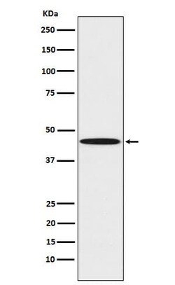 Serpin F1/PEDF Antibody (SR1798), Novus Biologicals 50 &mu;g; Unconjugated:Antibodies,