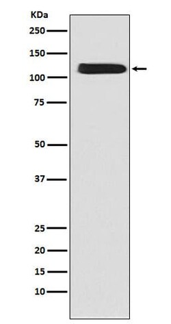 Sodium Calcium Exchanger 1/NCX1 Antibody (SR1046), Novus Biologicals:Antibodies:Primary