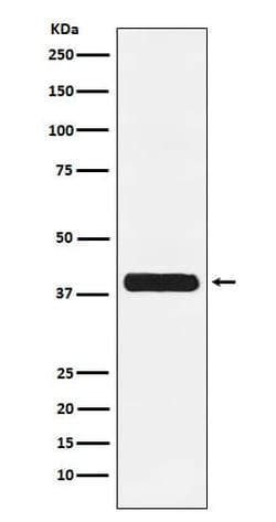 Glycophorin C Antibody (SR1653), Novus Biologicals 50 &mu;g; Unconjugated:Antibodies,