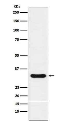 NKX3.1 Antibody (SR1533), Novus Biologicals 100 &mu;g | Buy Online | Novus Biologicals | Fisher Scientific