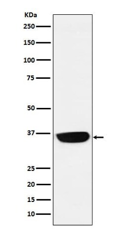 PHOX2B Antibody (SR1589), Novus Biologicals 50 &mu;g; Unconjugated:Antibodies,