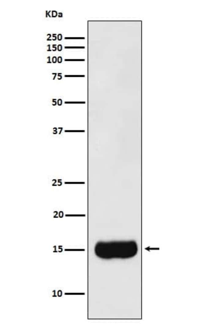 PSP94/MSMB Antibody (SR1218), Novus BiologicalsAntibodiesPrimary