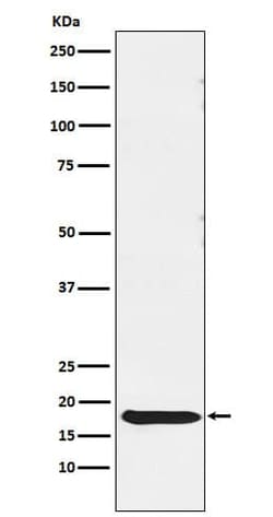 TSH beta Antibody (SR1242), Novus Biologicals 50 &mu;g; Unconjugated:Antibodies,