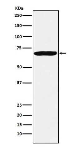IGF2BP3 Antibody (SR2134), Novus Biologicals:Antibodies:Primary Antibodies