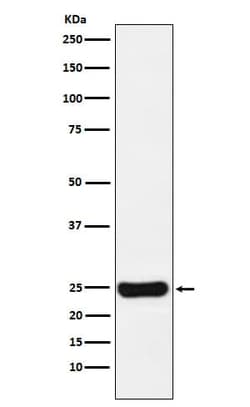 Cathepsin S Antibody (SR1393), Novus Biologicals 100 &mu;g; Unconjugated:Antibodies,