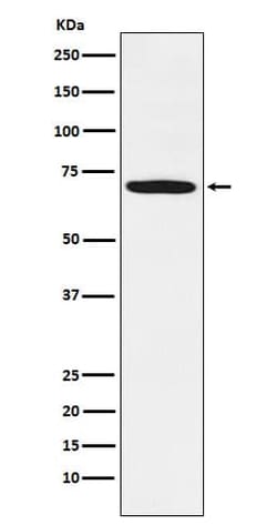 LIM Kinase 1 Antibody (SR2175), Novus Biologicals:Antibodies:Primary Antibodies