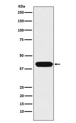 MATH1 Antibody (SR1642), Novus Biologicals 50 &mu;g; Unconjugated:Antibodies,