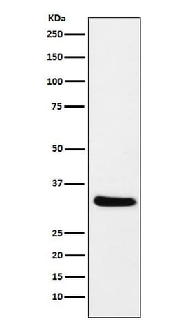 CRALBP Antibody (SR1596), Novus Biologicals:Antibodies:Primary Antibodies