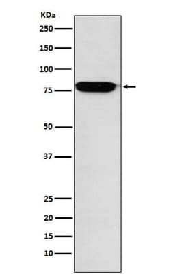 RANK/TNFRSF11A Antibody (SR2241), Novus Biologicals 50 &mu;g; Unconjugated:Antibodies,