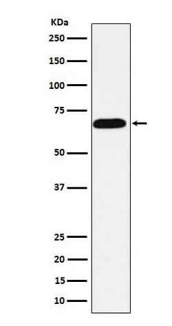Alkaline Phosphatase, Intestinal Antibody (SR2122), Novus Biologicals:Antibodies:Primary
