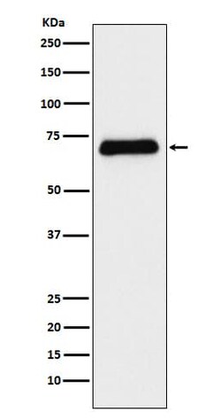 SLC6A4/5-HTTLPR/Serotonin transporter Antibody (SR2165), Novus Biologicals