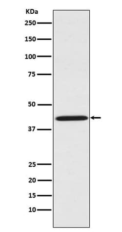 SPRY2 Antibody (SR1722), Novus Biologicals 100 &mu;g; Unconjugated:Antibodies,