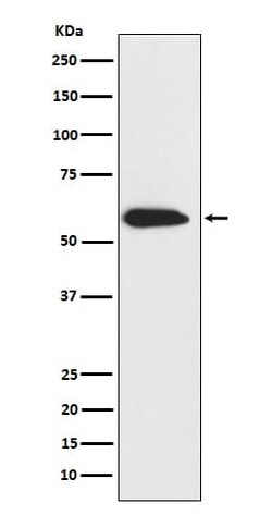 Cytokeratin 6 Antibody (SR2052), Novus Biologicals:Antibodies:Primary Antibodies