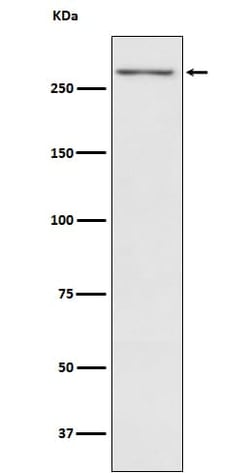 Thyroglobulin Antibody (SR1498), Novus Biologicals 100 &mu;g; Unconjugated:Antibodies,