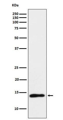 TCL1A Antibody (SR1149), Novus Biologicals 50 &mu;g; Unconjugated:Antibodies,