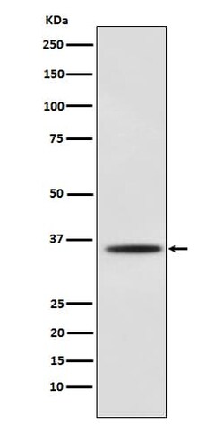 Myogenin Antibody (SR1600), Novus Biologicals:Antibodies:Primary Antibodies