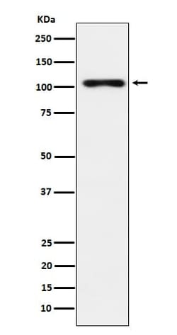 Thyroid Peroxidase Antibody (SR1031), Novus Biologicals 100 &mu;g; Unconjugated:Antibodies,