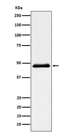 Pancreatic Lipase Antibody (SR1851), Novus Biologicals:Antibodies:Primary