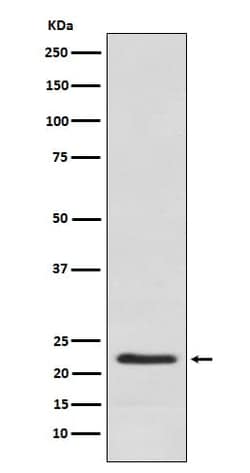 Placental Lactogen/CSH1 Antibody (SR1403), Novus Biologicals 100 &mu;g;