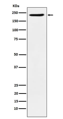 BAF180/PB1 Antibody (SR1306), Novus Biologicals:Antibodies:Primary Antibodies