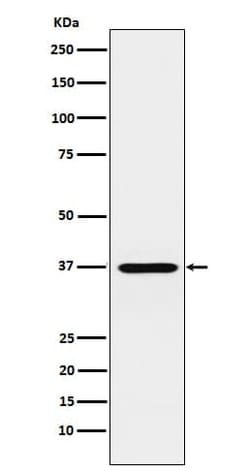 CRX/CORD2 Antibody (SR1615), Novus Biologicals:Antibodies:Primary Antibodies