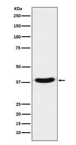 TRBP Antibody (SR1660), Novus Biologicals:Antibodies:Primary Antibodies