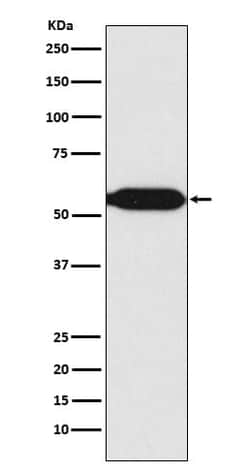 MEF2C Antibody (SR1855), Novus Biologicals 100 &mu;g; Unconjugated:Antibodies,