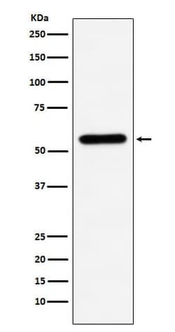 Carboxylesterase 1/CES1 Antibody (SR1990), Novus Biologicals:Antibodies:Primary