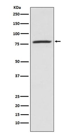 5-Lipoxygenase Antibody (SR2214), Novus Biologicals:Antibodies:Primary