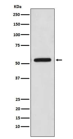 CaM Kinase II Antibody (SR1956), Novus Biologicals 50 &mu;g; Unconjugated:Antibodies,