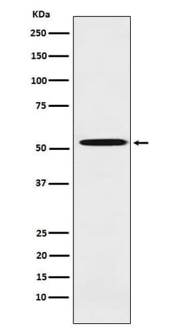 ALDH1A2 Antibody (SR2014), Novus Biologicals:Antibodies:Primary Antibodies