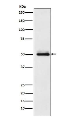Cytochrome P450 2C9 Antibody (SR1875), Novus Biologicals 100 &mu;g; Unconjugated:Antibodies,