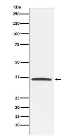 E2F6 Antibody (SR1531), Novus Biologicals:Antibodies:Primary Antibodies