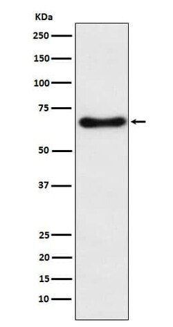 CYP24A1 Antibody (SR2038), Novus Biologicals 100 &mu;g; Unconjugated:Anticuerpos