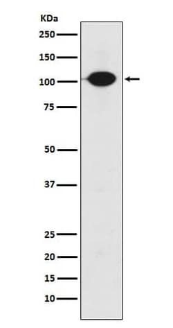 GABA-B R2 Antibody (SR1039), Novus Biologicals 100 &mu;g; Unconjugated:Antibodies,