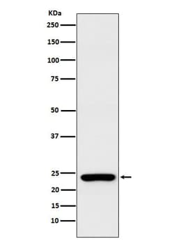 Rab25 Antibody (SR1367), Novus Biologicals 50 &mu;g; Unconjugated:Antibodies,