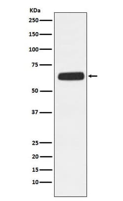 FCAR/CD89 Antibody (SR2145), Novus Biologicals:Antibodies:Primary Antibodies