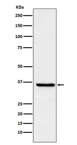 GSTO1 Antibody (SR1468), Novus Biologicals 50 &mu;g | Buy Online | Novus Biologicals | Fisher Scientific