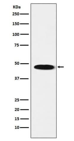 GABA-A R beta 1 Antibody (SR1833), Novus Biologicals 100 &mu;g; Unconjugated:Antibodies,