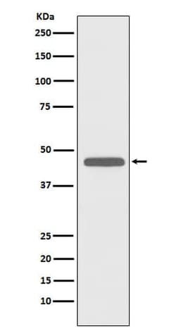 CD83 Antibody (SR1765), Novus Biologicals 100 &mu;g; Unconjugated:Antibodies,