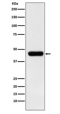 eIF4A1 Antibody (SR1793), Novus Biologicals:Antibodies:Primary Antibodies