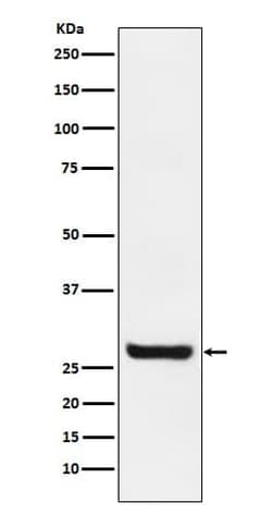 SPRY4 Antibody (SR1553), Novus Biologicals:Antibodies:Primary Antibodies
