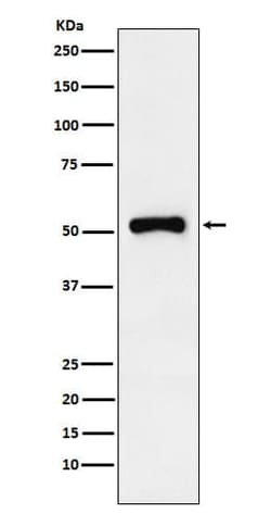 RAR gamma/NR1B3 Antibody (SR1891), Novus Biologicals:Antibodies:Primary