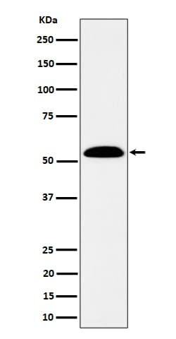 ALDH7A1 Antibody (SR1977), Novus Biologicals:Antibodies:Primary Antibodies