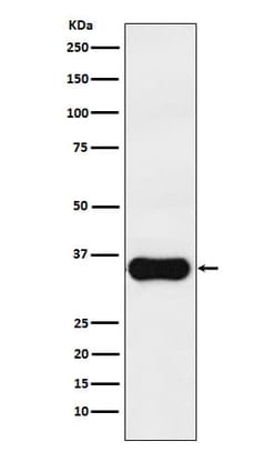 Melanocortin-1 R/MC1R Antibody (SR1585), Novus Biologicals 100 &mu;g; Unconjugated:Antibodies,