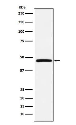 DARC Antibody (SR1582), Novus Biologicals:Antibodies:Primary Antibodies